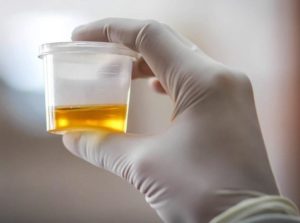 How Long does Alcohol Stay in your Urine