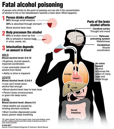 alcohol poisoning case study